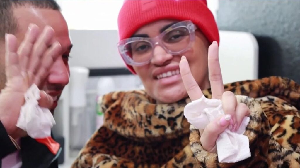 Leslye Rodríguez sale del hospital tras recibir disparo en la cabeza en la discoteca Toxic Lounge