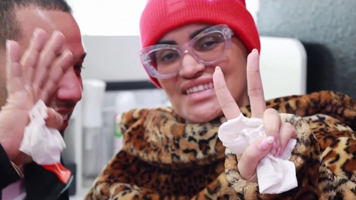 Leslye Rodríguez sale del hospital tras recibir disparo en la cabeza en la discoteca Toxic Lounge