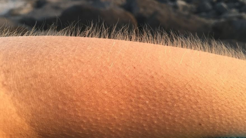 La razón por la que se nos pone la piel de gallina en determinados momentos