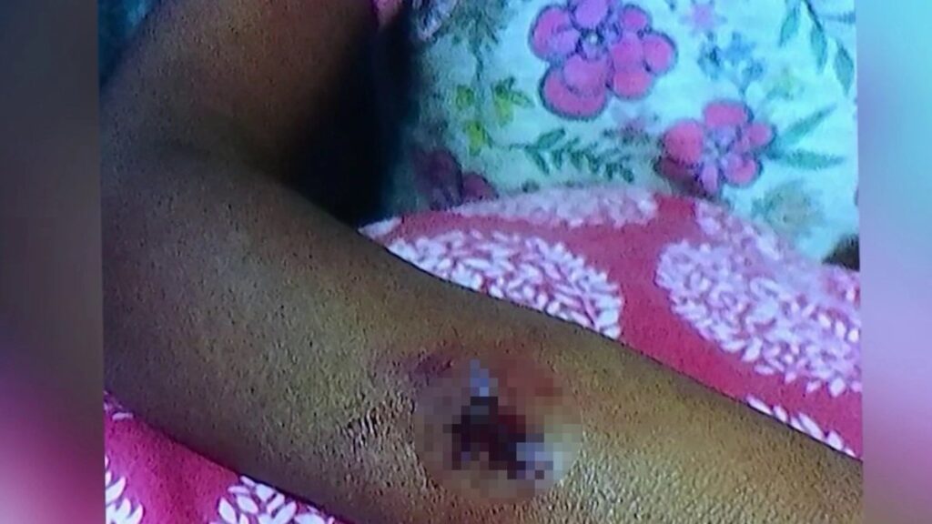 familia recibirá $100,000 tras ataque de perro en refugio