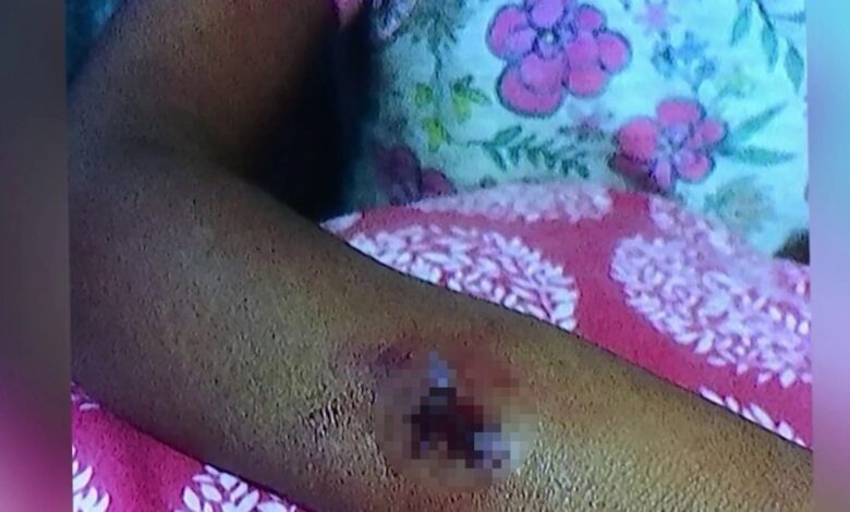 familia recibirá $100,000 tras ataque de perro en refugio