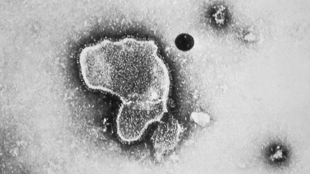 Asesores de la FDA recomiendan la aprobación de la primera vacuna en el mundo contra el VSR