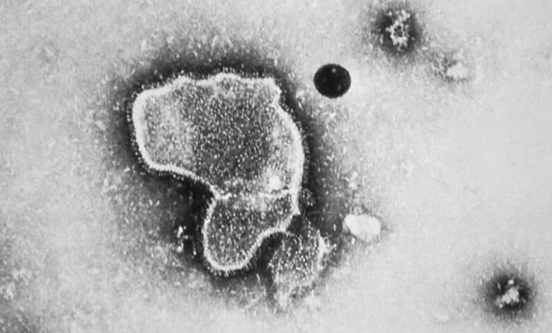 Asesores de la FDA recomiendan la aprobación de la primera vacuna en el mundo contra el VSR