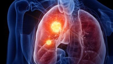 Llega a México la pastilla contra el cáncer de pulmón