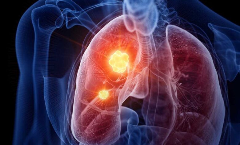 Llega a México la pastilla contra el cáncer de pulmón