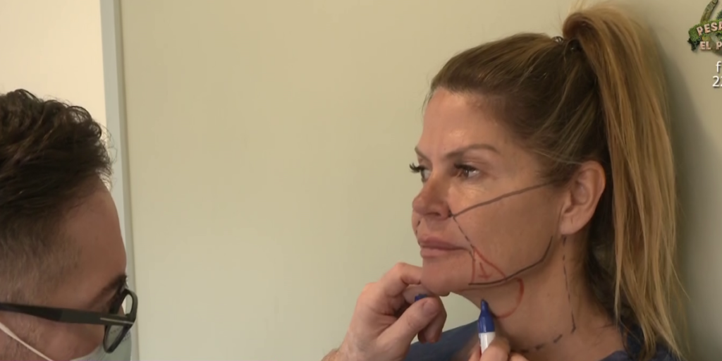 Makoke reaparece tras su operación de rejuvenecimiento facial: "Me han cortado..."