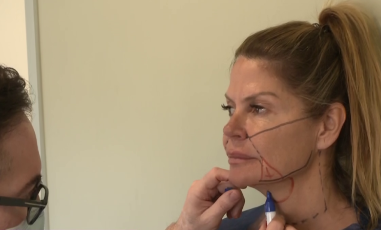 Makoke reaparece tras su operación de rejuvenecimiento facial: "Me han cortado..."