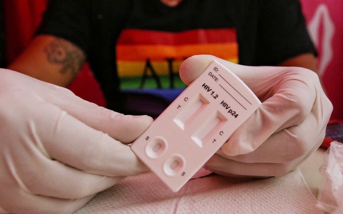 Un paciente alemán, el tercero del mundo que se cura del VIH