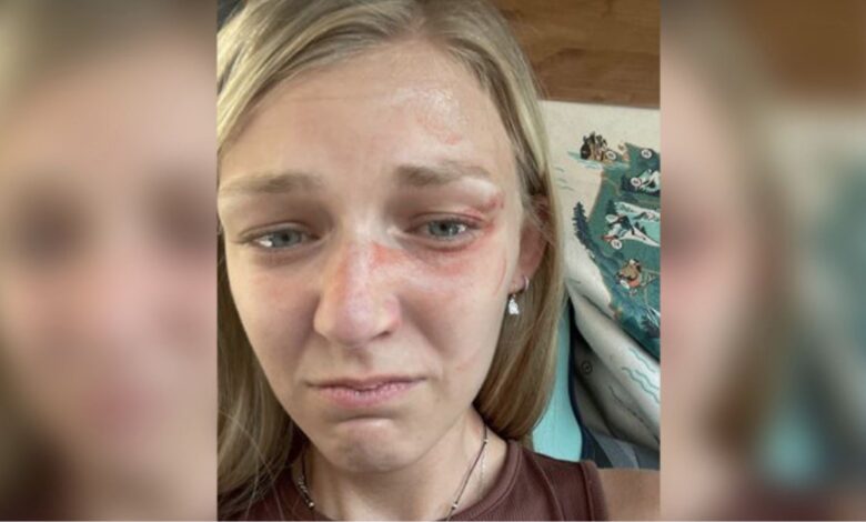 abogados revelan impactantes imágenes de Gabby Petito tras incidente de violencia doméstica con su novio Brian Laundrie en Moab en 2021