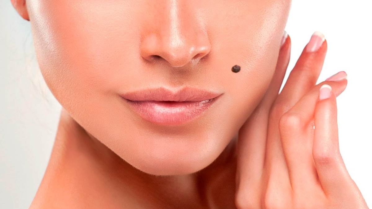 ¿Las verrugas son contagiosas?