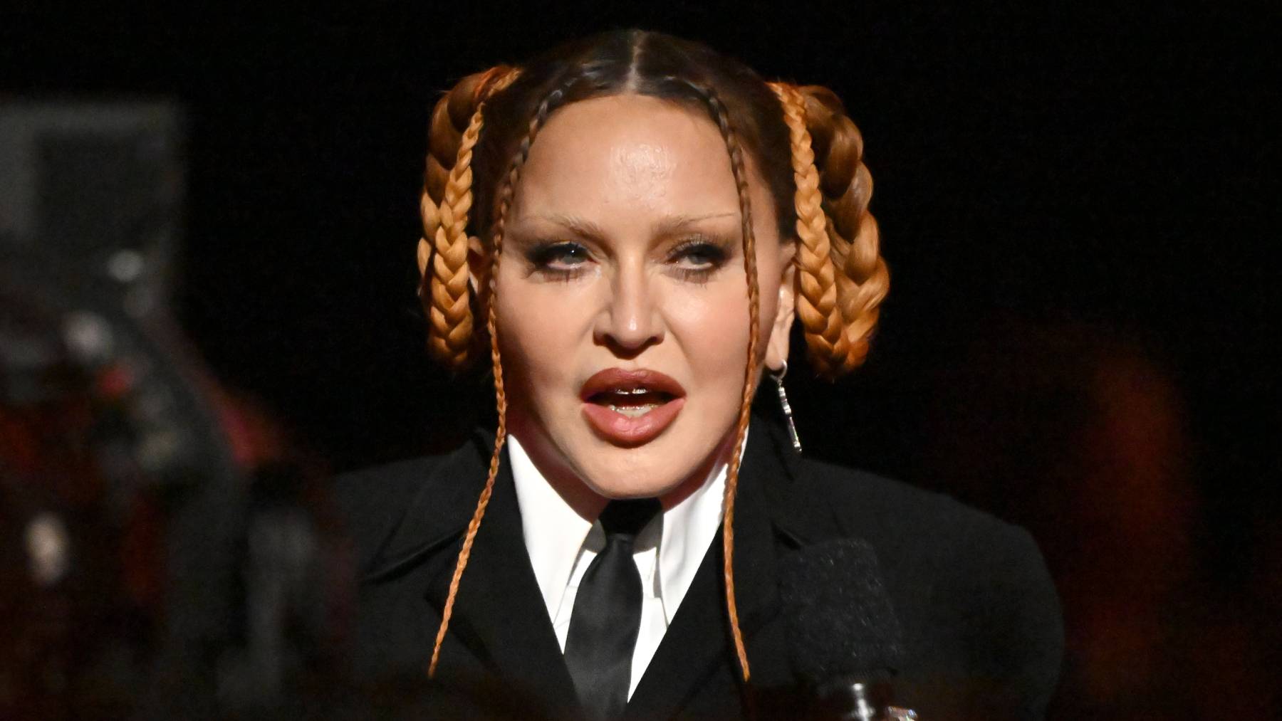 El desastre facial de Madonna que “padecen” otros famosos