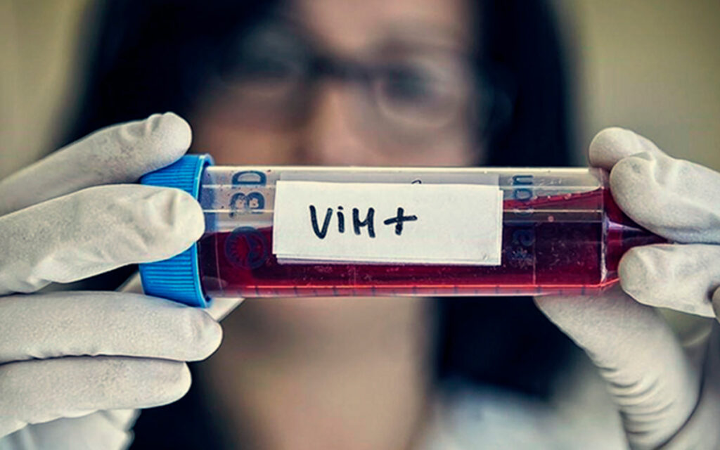 EU multiplica por 300 las personas tratadas contra el VIH en 20 años