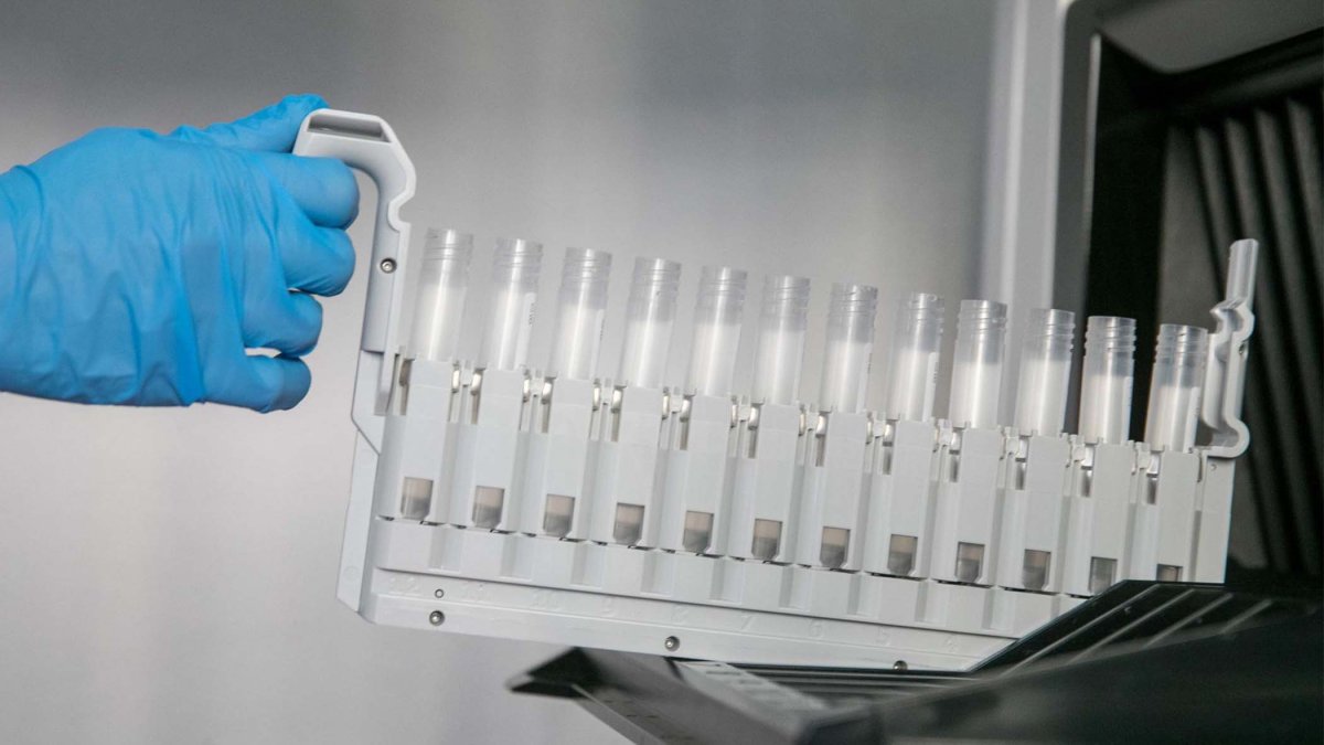 Fármaco experimental logra remitir la leucemia aguda en 18 pacientes, según estudios