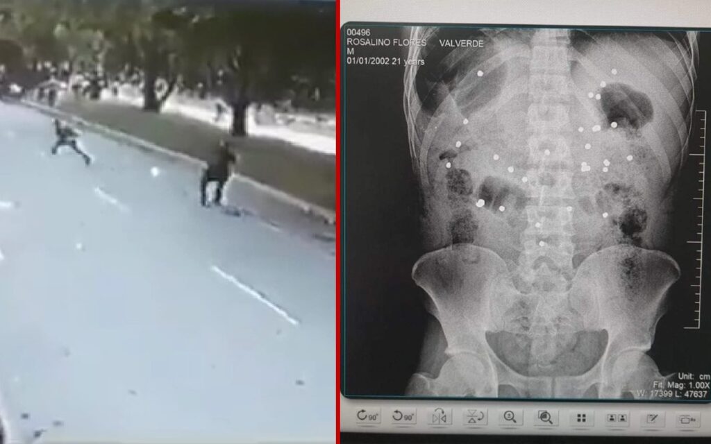 (Imágenes fuertes) Muere joven que recibió 36 perdigones durante protestas en Perú | Videos