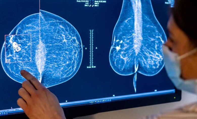 Nuevas reglas de la FDA para la realización de mamografías ayudarían a detectar el cáncer de seno
