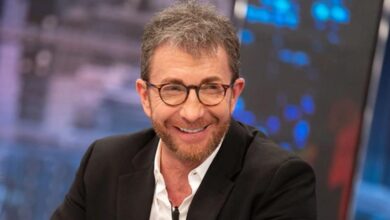 Pablo Motos muestra su último retoque estético en la cara: "Que corran los 'memes'"