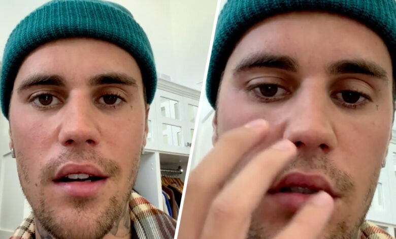 Video: Justin Bieber recupera su sonrisa meses después de sufrir parálisis facial