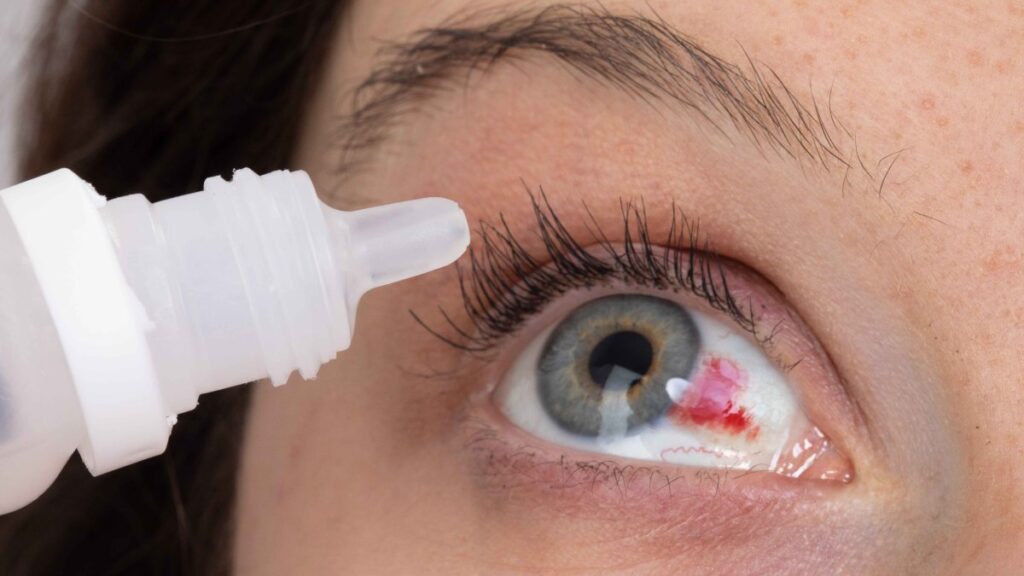 retiran de la venta dos marcas adicionales de gotas para los ojos distribuidas por Pharmedica y Apotex por riesgo de contaminación