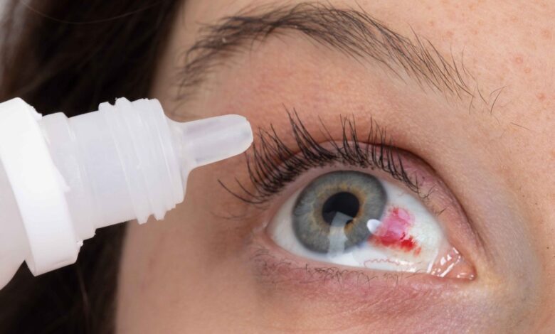 retiran de la venta dos marcas adicionales de gotas para los ojos distribuidas por Pharmedica y Apotex por riesgo de contaminación
