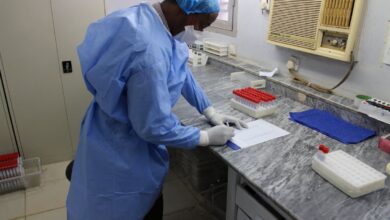 Advierten ‘alto riesgo de peligro biológico’ en Sudán tras incautación de laboratorio