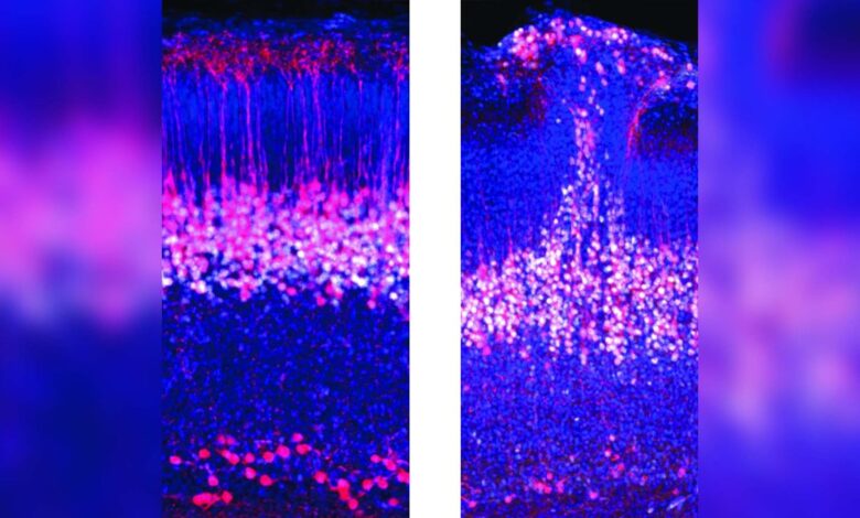 Impresionante hallazgo en el cerebro de los ratones podría aportar a la investigación sobre el autismo