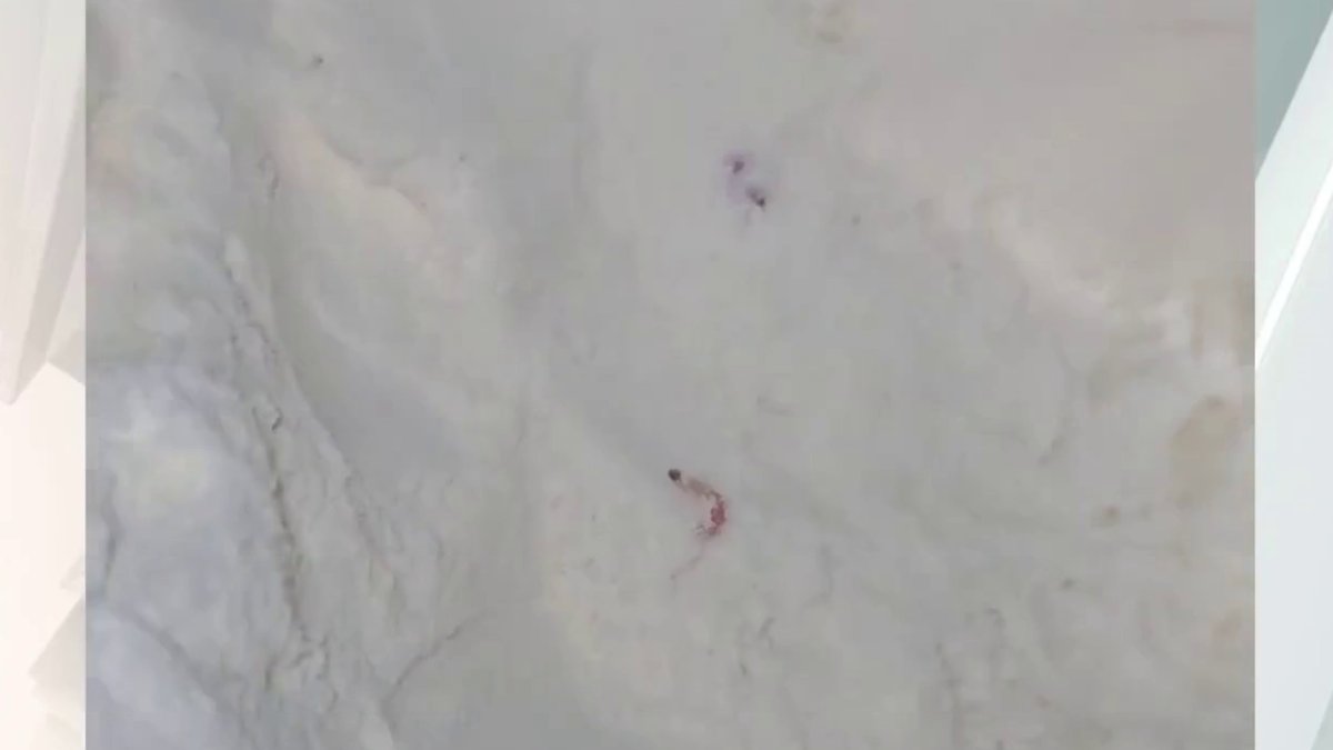 Madre de Texas halla gusanos en la fórmula para bebé que tomaba su hijo