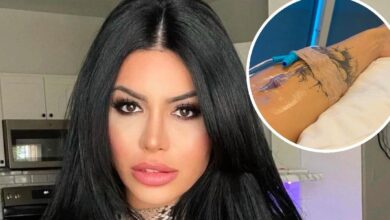Larissa Lima From 90 Day Fiancé glam pose with circular inset of surgery on arm