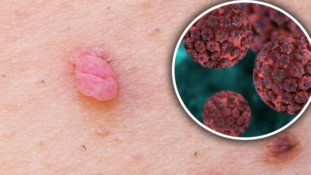 estudio indica que el virus del papiloma humano podría causar numerosos tipos de cáncer