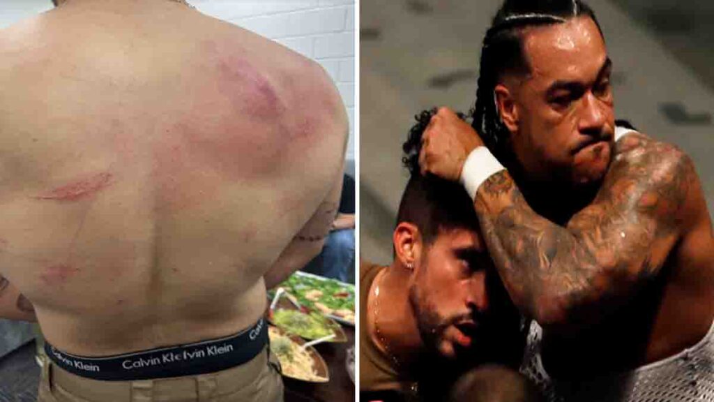 Bad Bunny muestra su espalda magullada, con arañazos y hematomas, tras evento de lucha libre