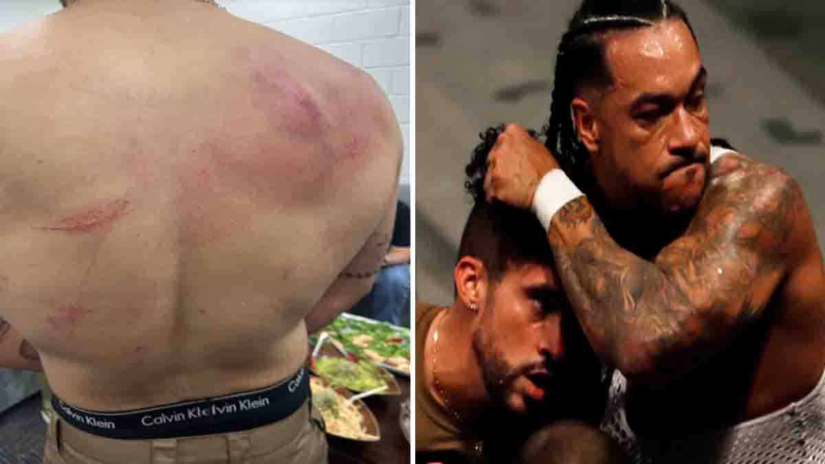 Bad Bunny muestra su espalda magullada, con arañazos y hematomas, tras evento de lucha libre