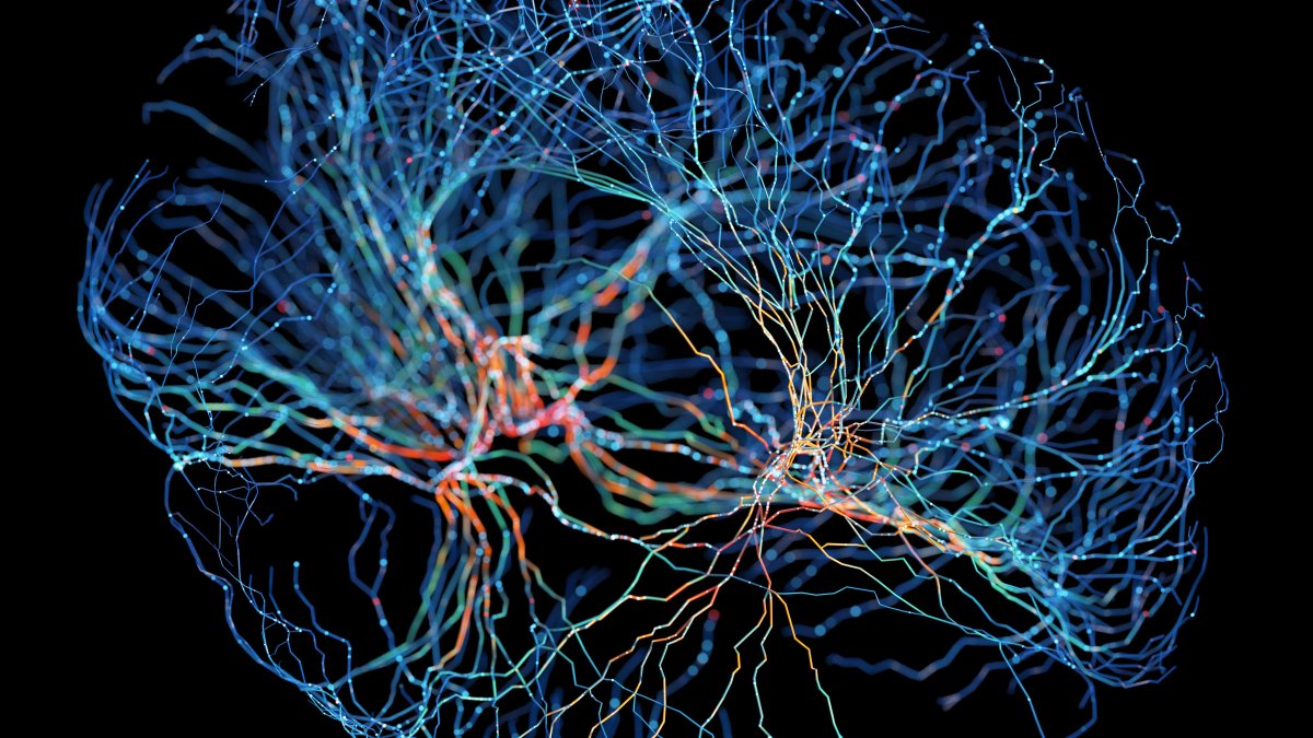 Estudio: la forma de tu cerebro puede influir fuertemente en tus pensamientos y comportamiento