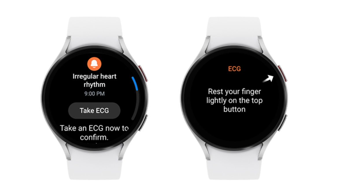 La función de notificación de ritmo cardíaco irregular de Samsung para el Galaxy Watch recibe la aprobación de la FDA