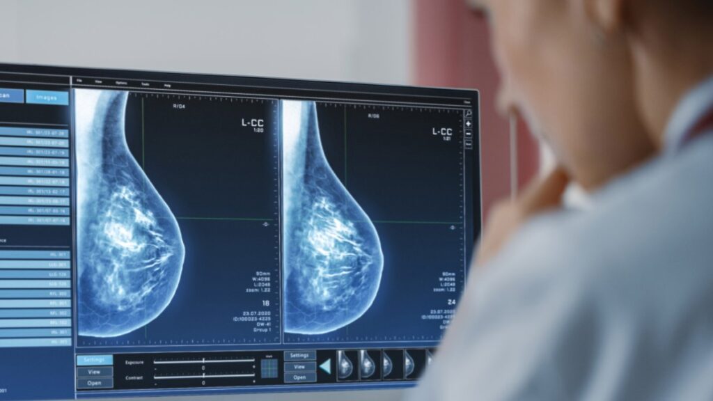 Nuevas guías para realizarse pruebas de detección de cáncer de mama