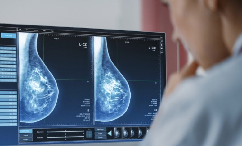 Nuevas guías para realizarse pruebas de detección de cáncer de mama