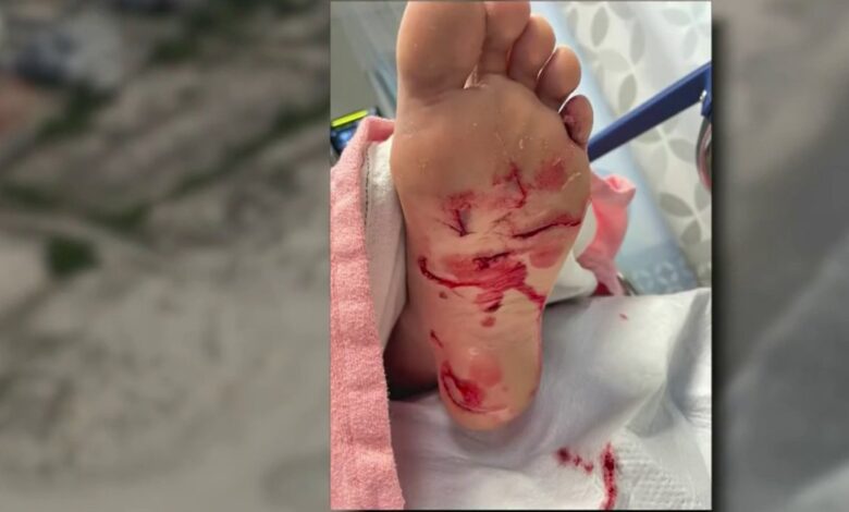 Quinceañera sufre mordida en playa de NJ consistente con una de tiburón