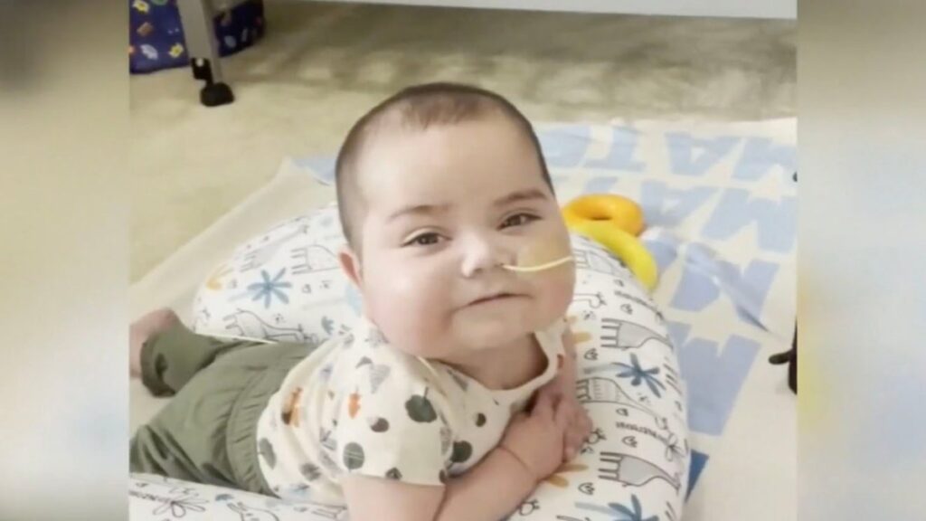 el bebé Mateo batalla contra una enfermedad del corazón