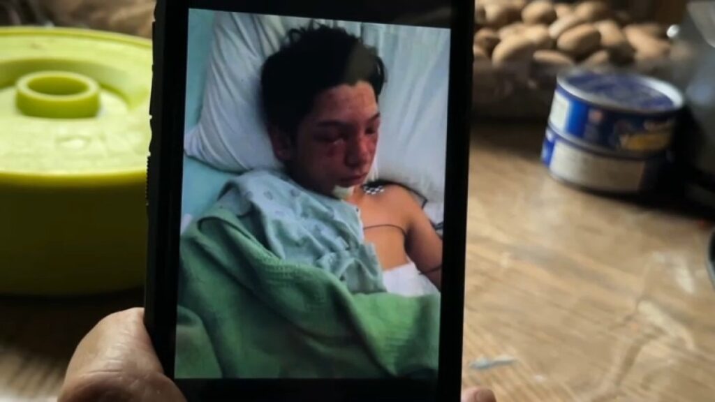 habla joven que perdió sus dedos tras detonar un fuego artificial