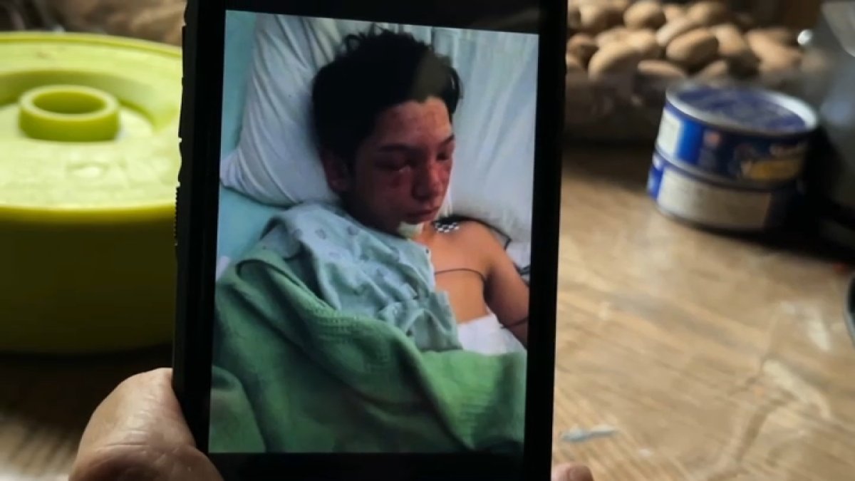 habla joven que perdió sus dedos tras detonar un fuego artificial