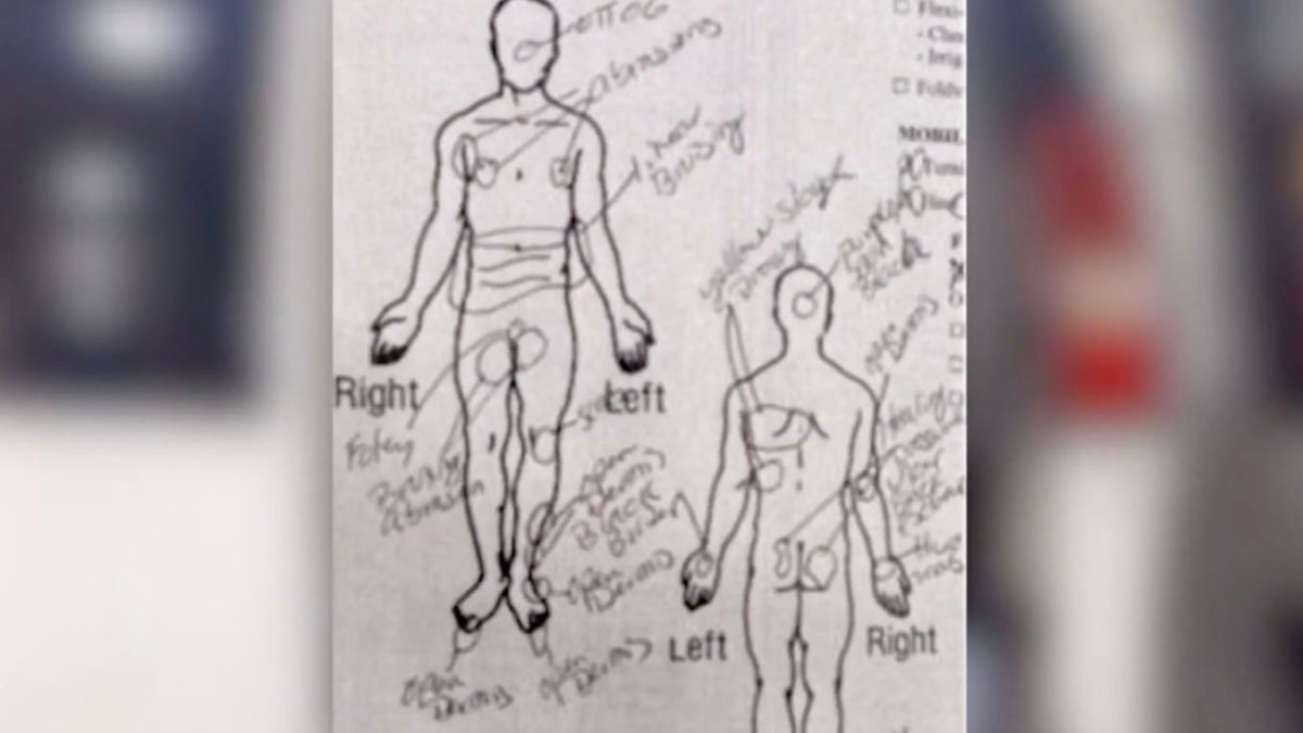 investigan un caso de abuso y “tortura” a una mujer discapacitada