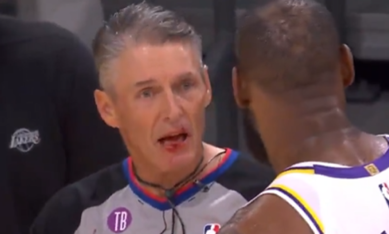 ¡LeBron golpea y deja sangrando al árbitro!