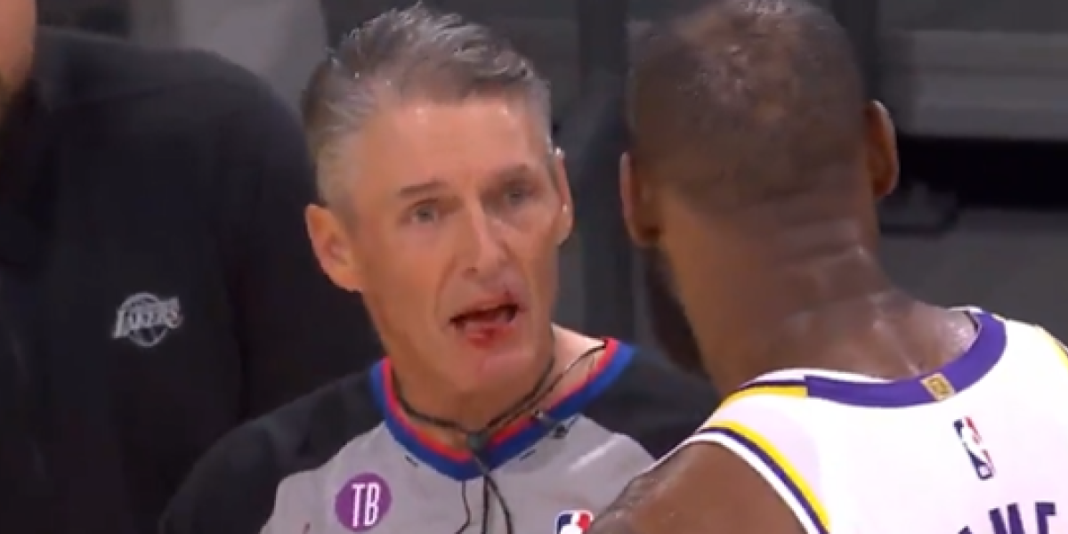 ¡LeBron golpea y deja sangrando al árbitro!