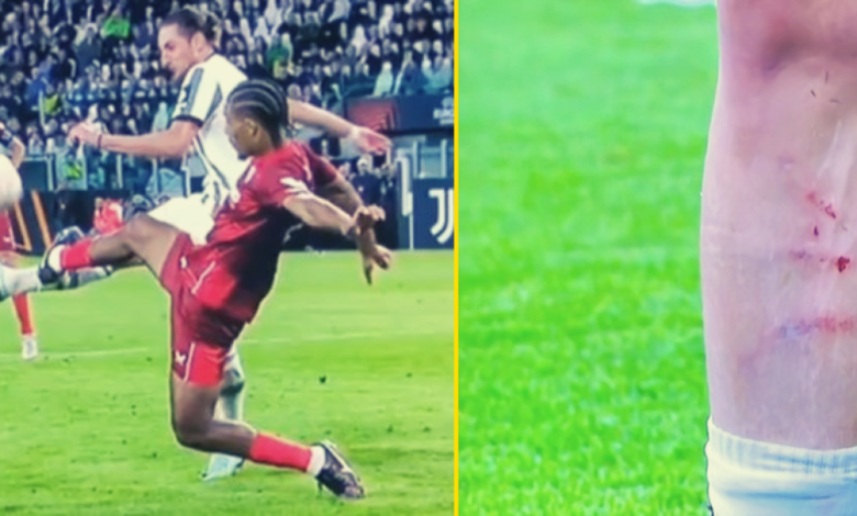 ¿Cómo no fue penalti? ¡Así le quedó la pierna a Rabiot tras el entradón de Badé!