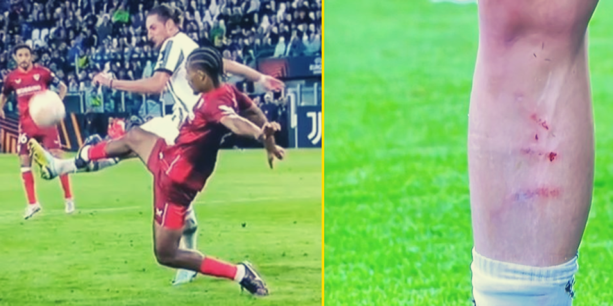 ¿Cómo no fue penalti? ¡Así le quedó la pierna a Rabiot tras el entradón de Badé!