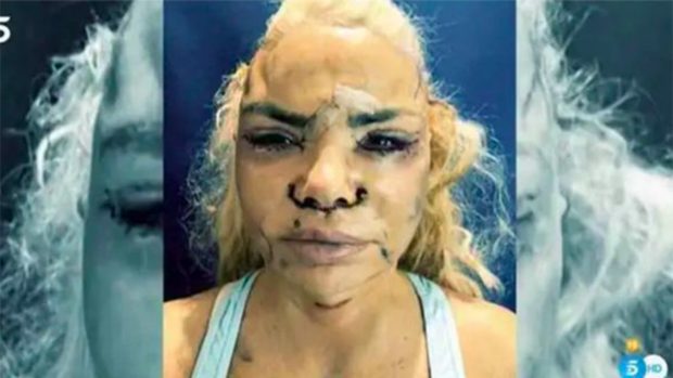 Leticia Sabater se opera / Telecinco