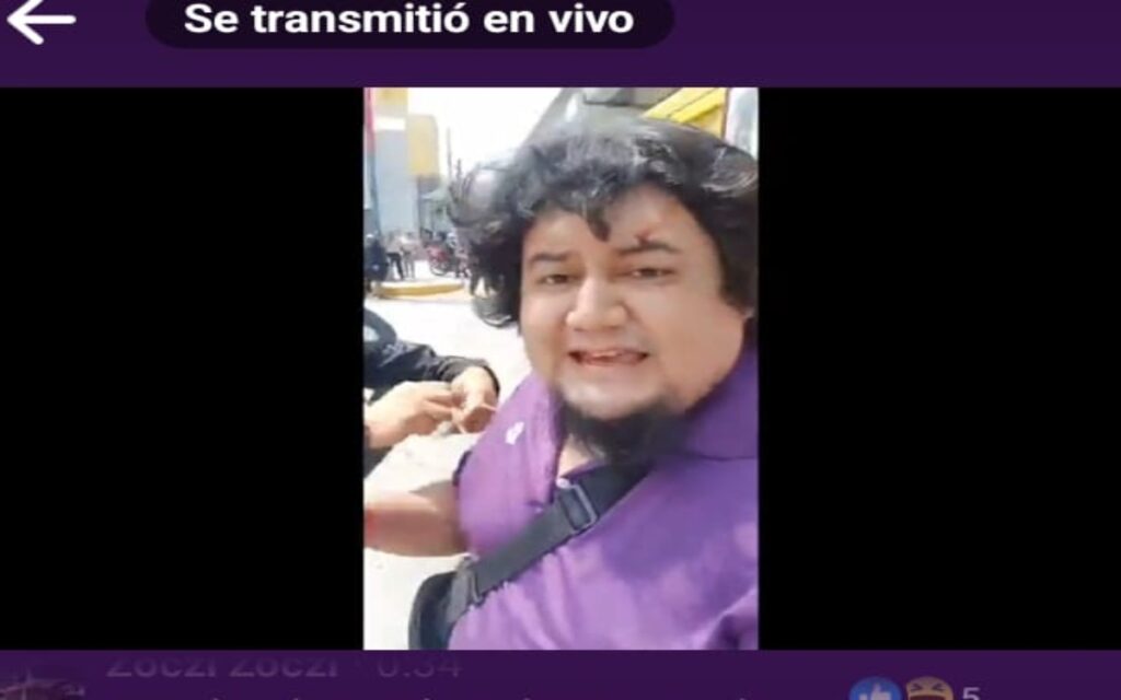 Agreden a reportero en Guerrero: 'me estoy desangrando'