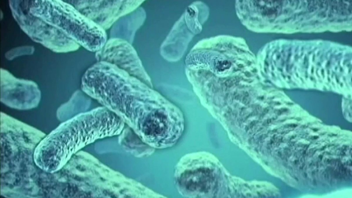 Brote de meningitis en EEUU tras visitas a clínicas en México