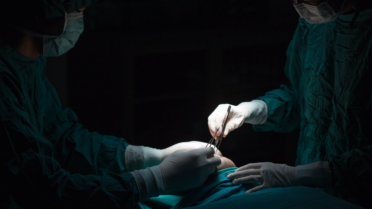 Estudio: nuevo método quirúrgico podría expandir los trasplantes de corazón a miles de pacientes