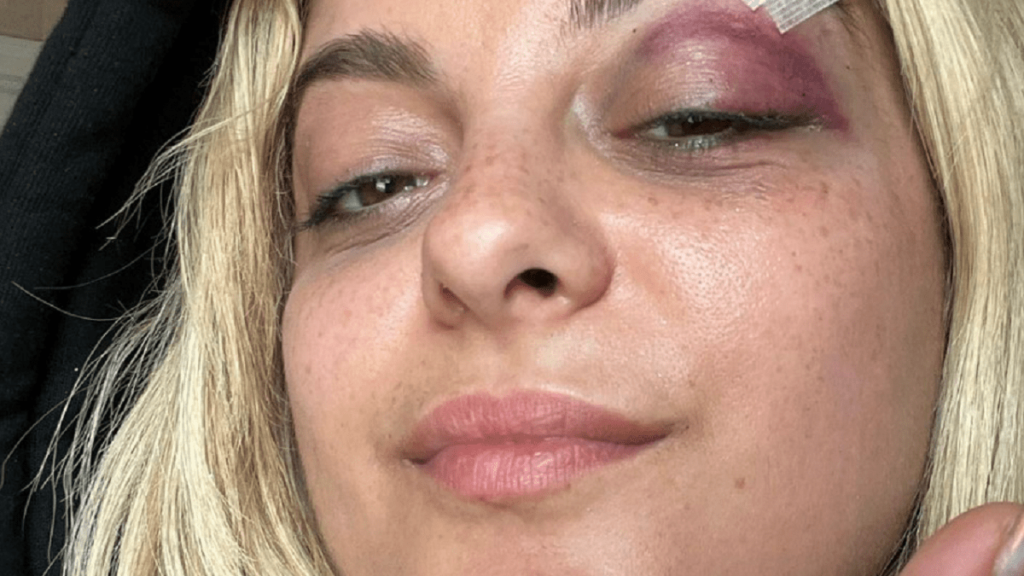 Pensaba que “sería divertido”: momento en que fanático lanza y hiere con su celular a la cantante Bebe Rexha