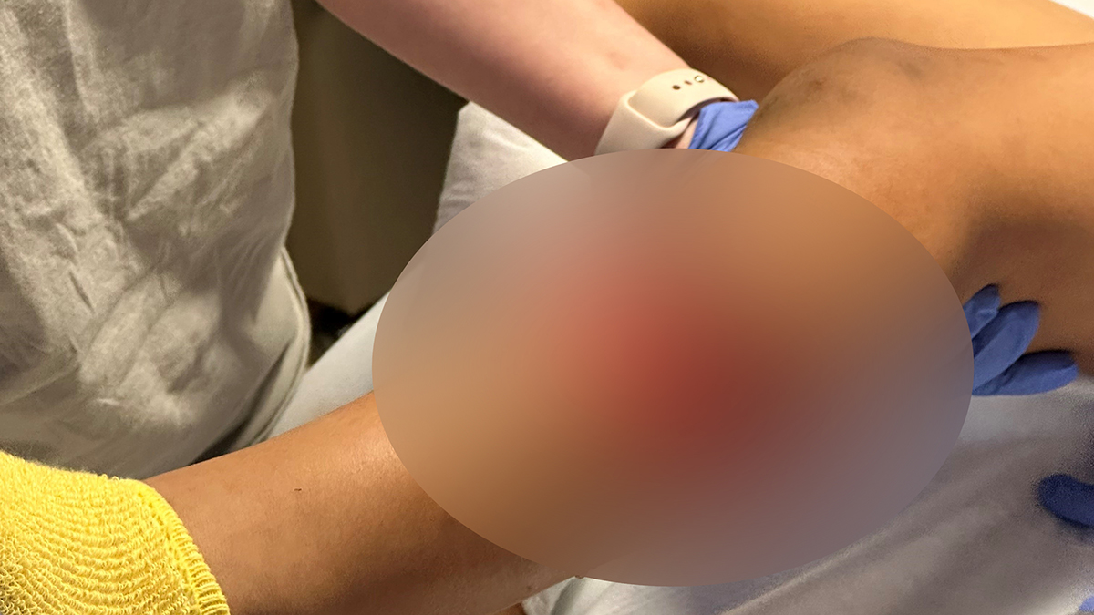 pitbull ataca a niño y le causa graves lesiones