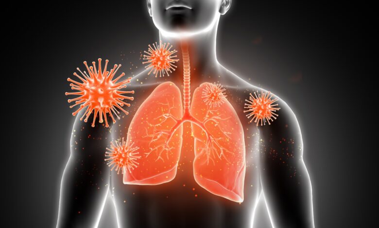 1 millón podrían morir de tuberculosis para 2025 si no se toman medidas: ONU